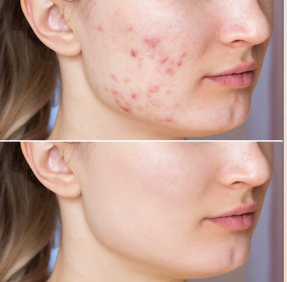 Glycolic Serum